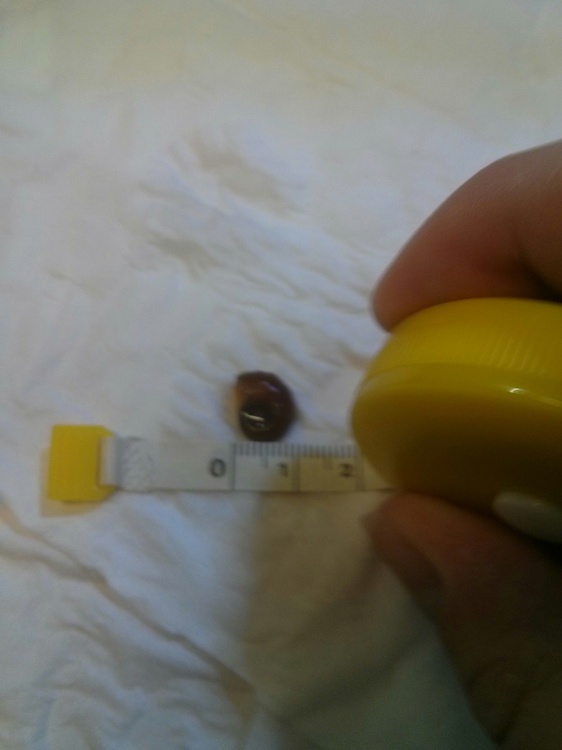 murderedsnail.jpg